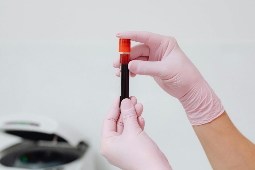 O plasma é a parte líquida do sangue e é rico em proteínas essenciais, como albumina, imunoglobulinas e fatores de coagulação |